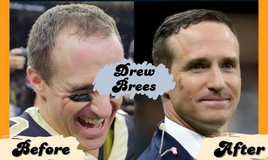 Drew Brees Makes His Nbc Debut, Internet Amazed By His New Hair