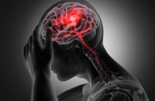 Recognizing the Key Symptoms of Stroke: Early Warning Signs to Look Out For 